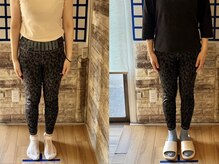 整体院リノベボディ(リノベBODY)/悩み：脚のフォルム［40代］