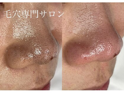 アネモネ(ANEMONE)の写真