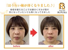 ブプラ つくば店(BUPURA)/before→after　２