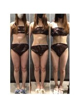 フローボディ 新山口店(flow BODY)/山口のエステはflow BODY