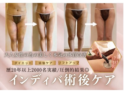 スリーピングビューティー(Sleeping Beauty)の写真