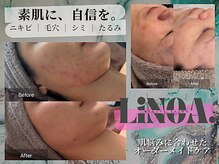 リノアドット(LiNOA.)