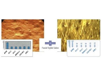 フェイシャルスタイリストサロン 四谷店/ケア例(61)
