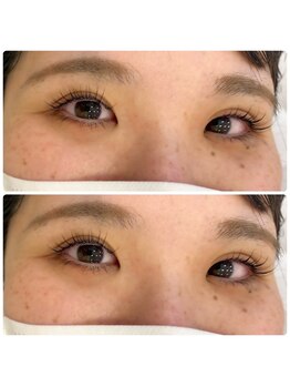 ジョリー(Jolie)/