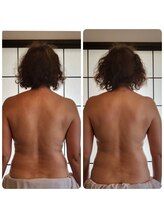 縁 エン/超人気！バックトリートメント☆