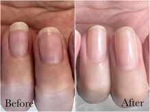 アンベリール(embellir.)/自爪育成で美爪に変身！