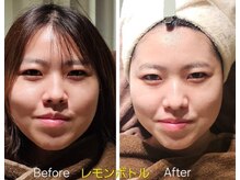 アン 銀座(ann)/レモンボトル