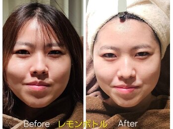 アン 銀座(ann)/レモンボトル