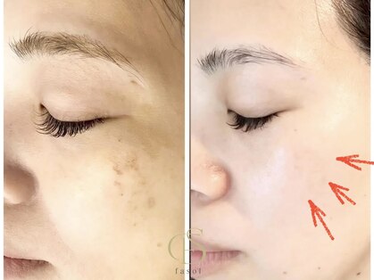 ファソ ブロウアンドアイズ(fasol)の写真