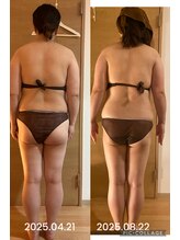 シエスタ リラクゼーションアンドデトックス(Siesta Relaxation&Detox)/痩せなかった下半身がスッキリ