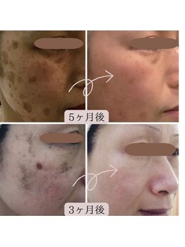 エターナルビューティー(eternal beauty)/