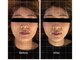 リアルボイス(REAL VOICE)の写真