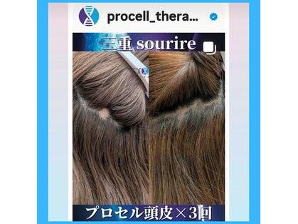 スリール(sourire)の写真