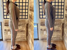 整体院リノベボディ(リノベBODY)/悩み：産後体型［30代］