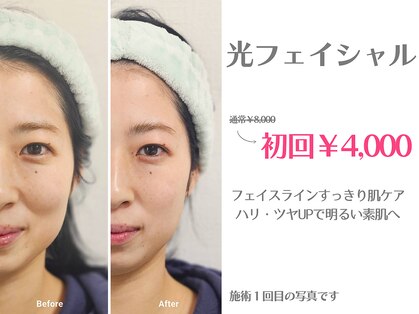 シェリ(Cherii)の写真