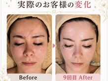 ハナヨサロン(hanayo salon)の雰囲気(【免疫力UP】痩身やブライダルにも大変人気なコース◎)