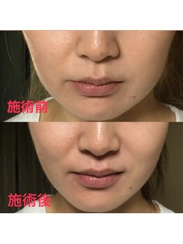 ゆるっくす/小顔整体