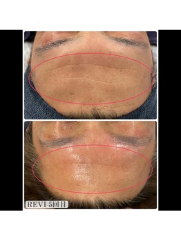 ヘルバ(HERBA)/フェイシャル