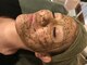 シースタイル(C-S.t.y.l.e.)の写真/【本気のニキビケア】お肌が変われば人生が変わる！徹底ニキビケア！