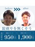 【人気No1】ヒゲ剃無くして快適生活!ヒゲ脱毛 初回限定 通常¥4,000→￥1,900