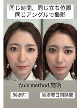 シェリーナ(cherieNa)/フェイスメソッドの翌日の変化