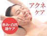 【気になる凸凹肌・ニキビケアに◎】アクネ菌ケア+深層毛穴洗浄 60分¥4400