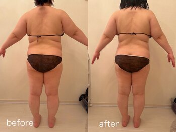 クロレ 浦和店(CLORE)/30代のお客様/8回施術