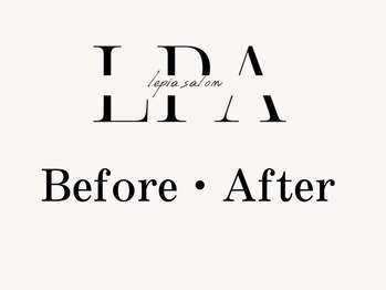 レピア 郡山駅前店/ 韓国式LEPIA Before&After