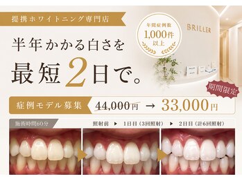 ブリエ 久屋大通店(BRILLER)/高効果ホワイトニング 2日間