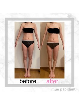 ミュー パピヤン(mue papillant)/ハイパーナイフEXで驚きの変化!!