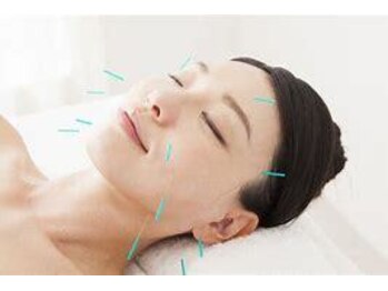 あやのはりきゅう整骨院/大人気の美容鍼