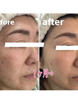 アズ(AZU)/50代女性before After‐