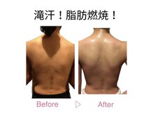 ヨサパーク ソノリテ みなみ野店(YOSA PARK sonorite)の雰囲気（ぽっこり腹/二の腕/太もも/ハミ肉/ウエストもお任せ下さい！）
