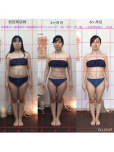 ディライト(D-LIGHT)/6ヶ月間本気ダイエット！