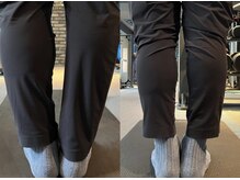 ハーモニーフィットネス 赤坂(Harmony Fitness)の雰囲気（施術4回での変化！O脚改善[赤坂/整体/肩こり/疲労回復]）