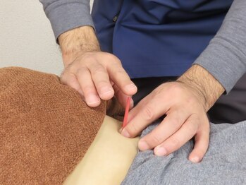 あすなろ鍼灸整骨院の写真/『身体の不調を改善して心身共に健康に◎』なかなか改善されないお悩みには鍼灸施術をお試しください★