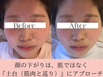 ミリグラム(mg)の写真/大切な日の前に仕上げる！顔の下がりは、肌ではなく『土台』！止まらないたるみにサヨナラ♪感動小顔へ◎