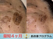 アトリア(ATRIA)の雰囲気（【Dr.PUR BEAUTE】肌質から変える、最短4ヶ月の集中肌ケア）