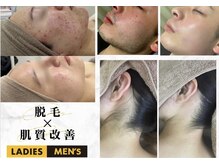アルゴ 福津店(ALGO)の雰囲気(【美肌脱毛専門店】の脱毛×フェイシャルで本気の肌質改善♪)