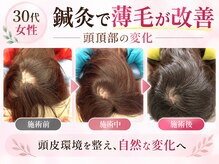 さがみ鍼灸整骨院の雰囲気（抜け毛など女性のお悩みには美髪鍼）