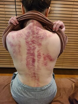 りふ/グアサー(カッサの様子)。