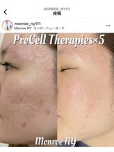 ネイルズアオアクア(Nail's AO AQUA)/プロセルフェイシャル