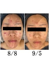 ヘルバ(HERBA)/フェイシャル