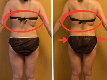 サラン(Sarang)/背中のハミ肉スッキリ☆