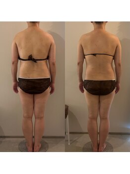 ラナ 京都西院店(Lana)/よもぎ蒸し＆リンパマッサージ