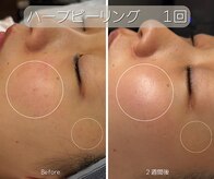 アンナビューティ 六本木 乃木坂店(Anna Beauty)