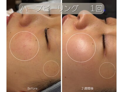 アンナビューティ 六本木 乃木坂店(Anna Beauty)の写真