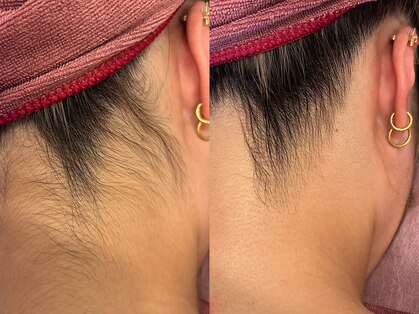 ビューティービレッジ(Beauty village)の写真
