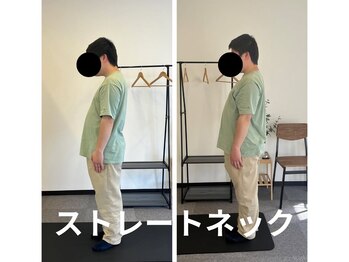 カワル整体 長嶺院/ストレートネック