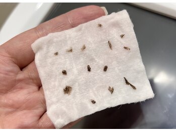 エターナルビューティー(eternal beauty)/